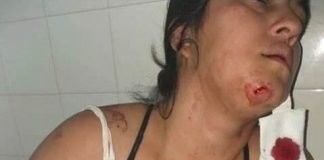 La justicia recién actuó luego que se viralizara un caso de extrema violencia