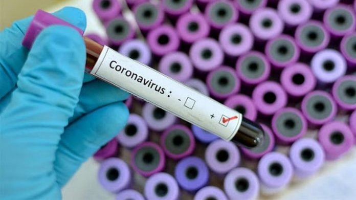 Coronavirus en Catamarca: ayer se detectaron 71 casos positivos