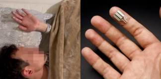 Ciencia y tecnología: la revolución del ‘biohacking’ para transformar nuestros cuerpos mediante chips