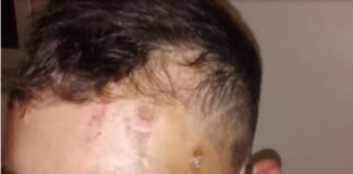 Denuncian a adicionales por brutal golpiza en un boliche