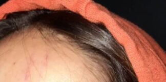 Quiso denunciar una golpiza y no le quisieron tomar la denuncia