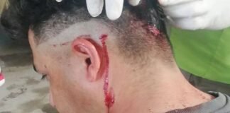 Investigan un violente ataque en un taller mecanico