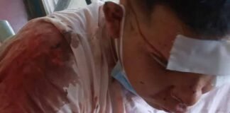 joven patoteado que perdió un ojo también sufrió fractura de craneo en riña en Alto Fariñango