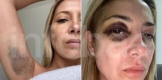 Difunden chats y fotos de Fabiola Yañez con signos de haber sido golpeada por Alberto Fernández