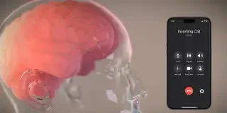 Neuralink, la polémica empresa de chips cerebrales de Elon Musk, dice que pondrá 20.000 implantes al año