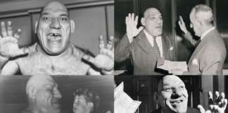 El hombre que por una deformidad física, inspiró la creación de “Shrek”
